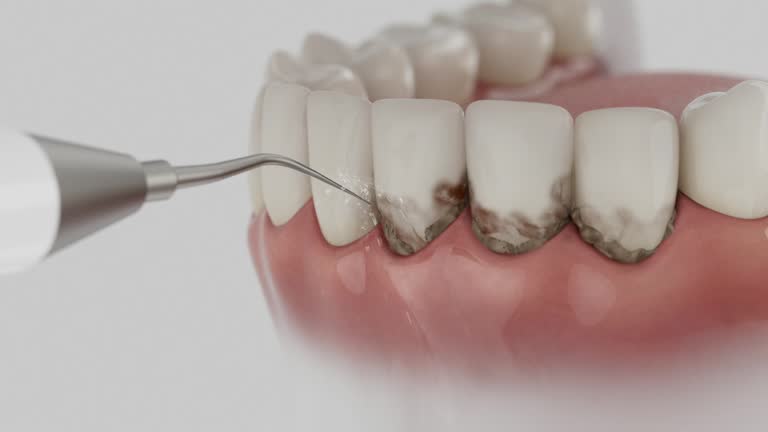 Trusted Teeth Cleaning And Checkup service in Chesapeake, WV - Dentist Open Now